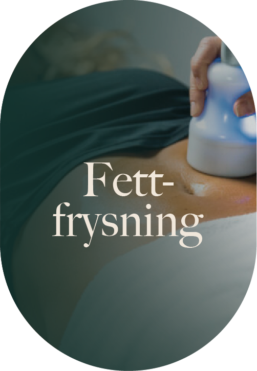 Fettfrysning